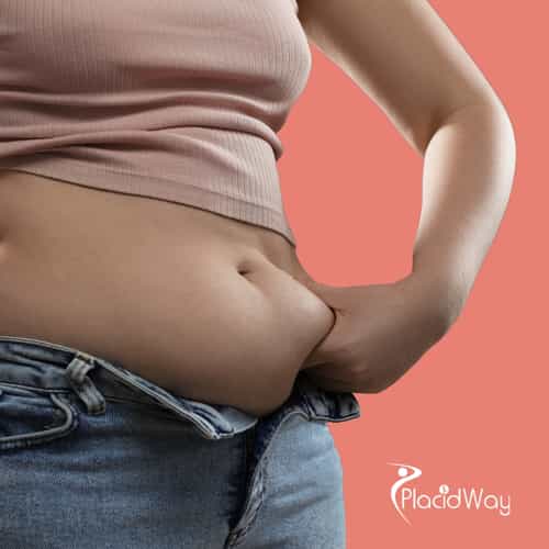 La guía venezolana para transformaciones corporales asequibles y de primer nivel para mamás en Colombia.